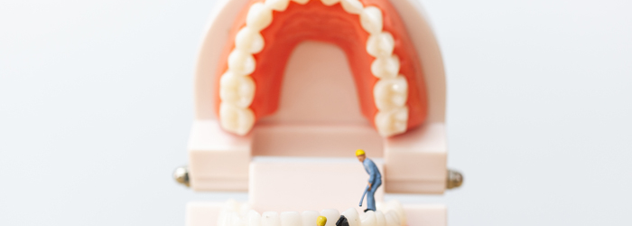 Seis Síntomas que nos alertan de la existencia de Caries Dentales